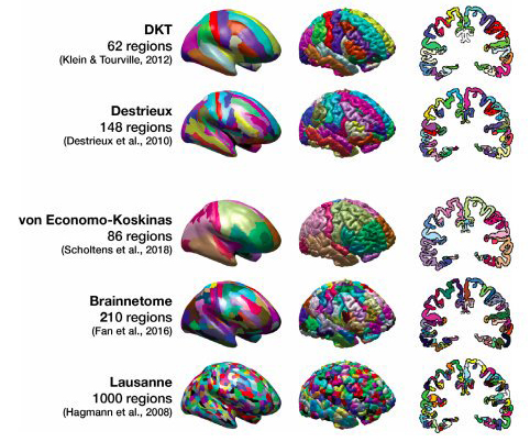 Predicting age from cortical structure across the lifespan
