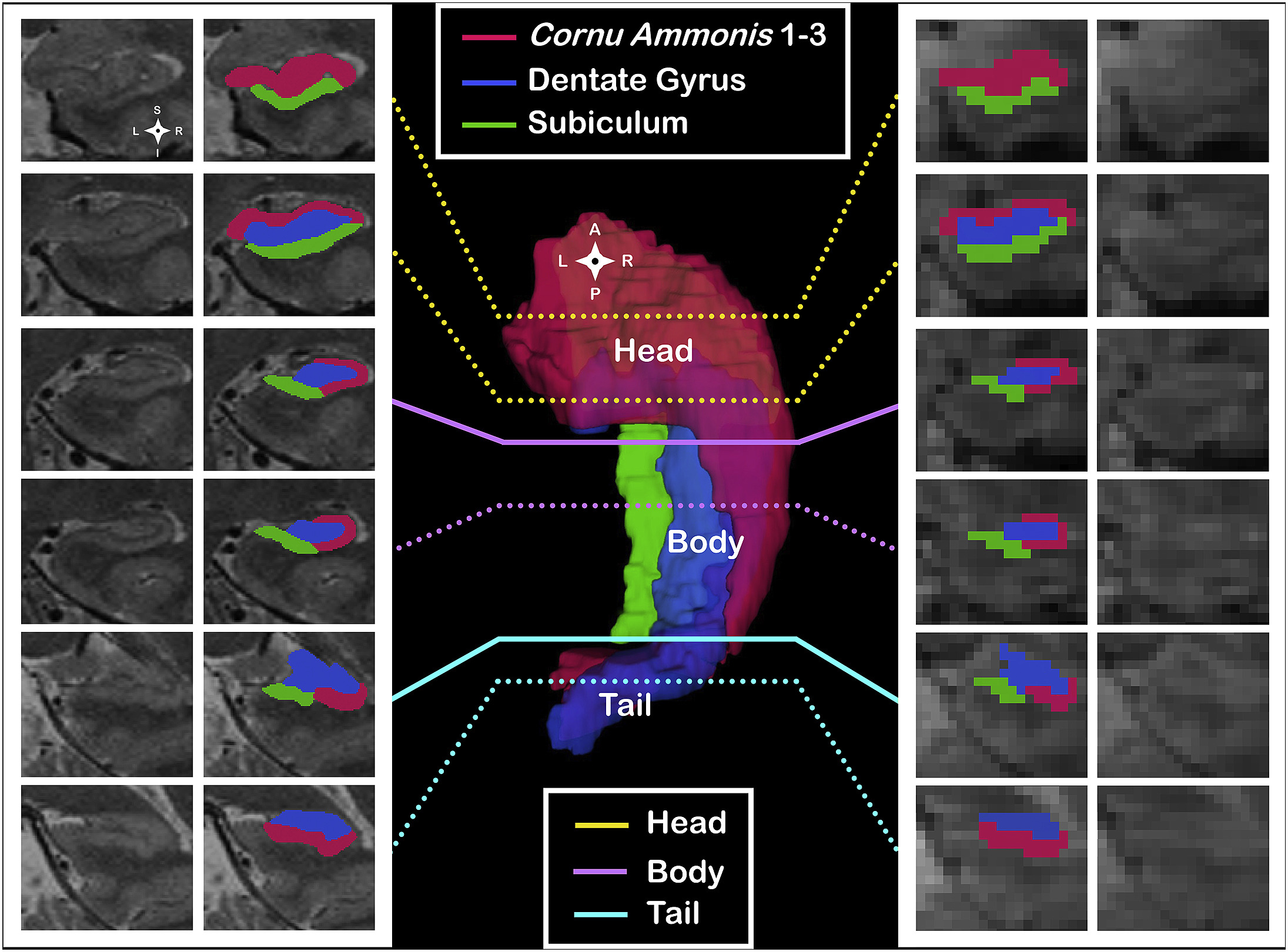 Involvement of hippocampal subfields and anterior-posterior subregions in encoding and retrieval of item, spatial, and associative memories: Longitudinal versus transverse axis