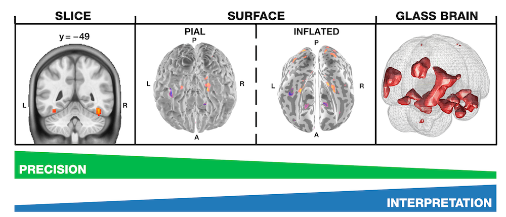 Data visualization for inference in tomographic brain imaging