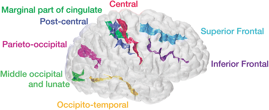 Robust estimation of sulcal morphology