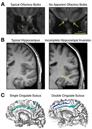Scan Once, Analyse Many: Using Large Open-Access Neuroimaging Datasets to Understand the Brain